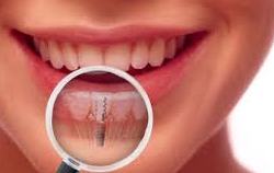 smiling woman